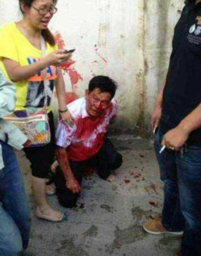 湖南衡东人大代表会后遭刀捅