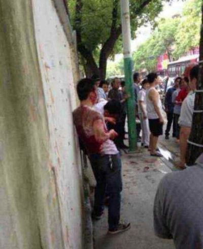 湖南衡东人大代表会后遭刀捅