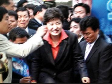 朴槿惠面部为什么会有一道11厘米长的伤口？