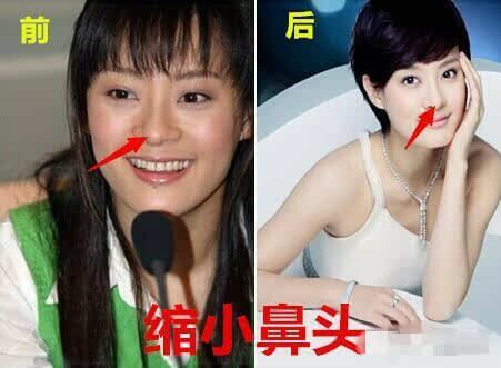 《芈月传》拼收视不惜再爆孙俪整容门