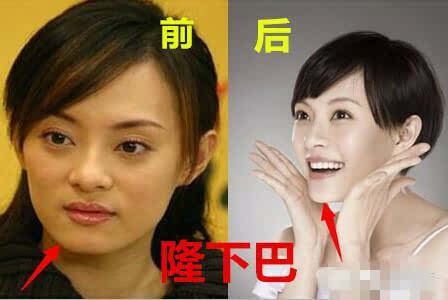 《芈月传》拼收视不惜再爆孙俪整容门