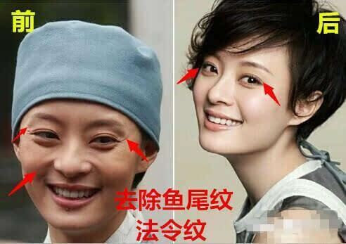 《芈月传》拼收视不惜再爆孙俪整容门