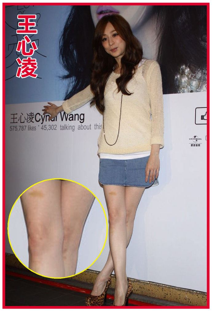 王珞丹微博晒膝盖淤青照与内心单纯有关吗?
