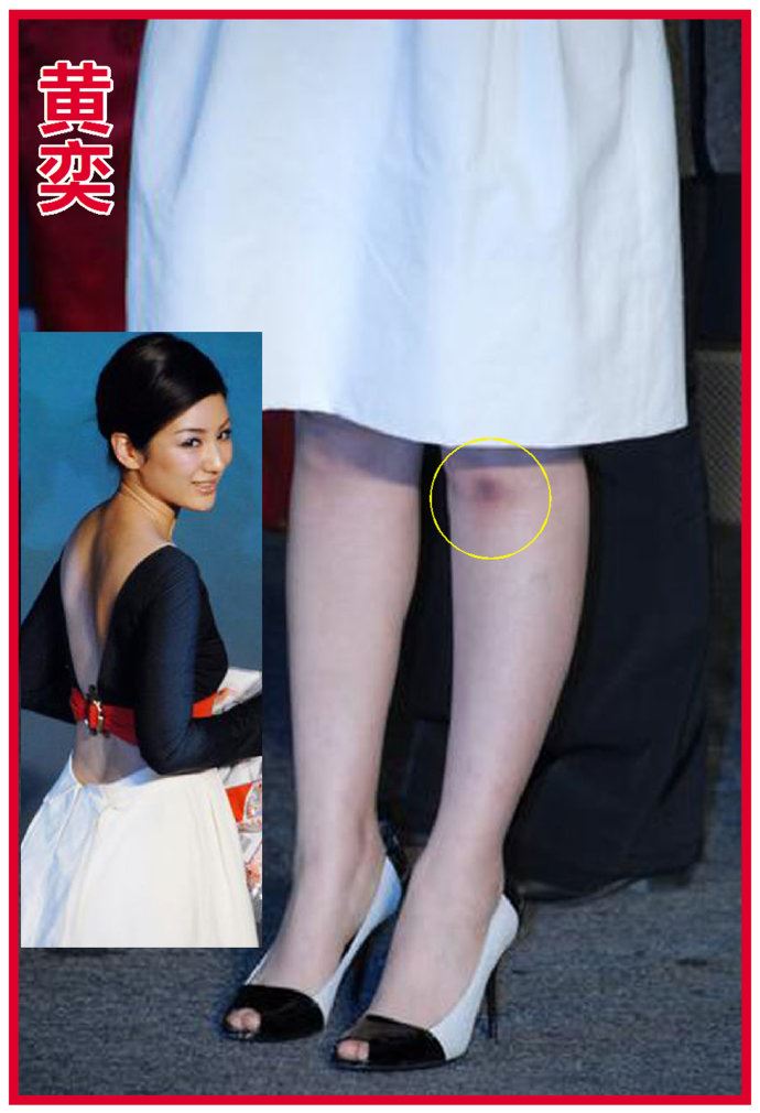 王珞丹微博晒膝盖淤青照与内心单纯有关吗？