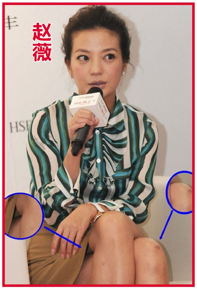 王珞丹微博晒膝盖淤青照与内心单纯有关吗？