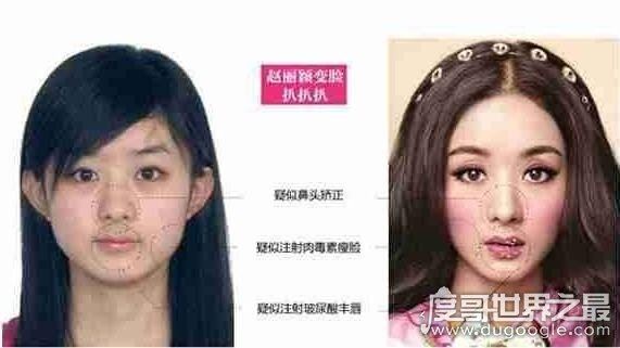 赵丽颖整容前后照片对比,整张脸完全不同了