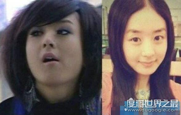 赵丽颖整容前后照片对比，整张脸完全不同了