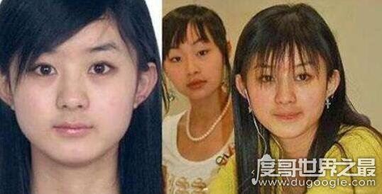 赵丽颖整容前后照片对比，整张脸完全不同了