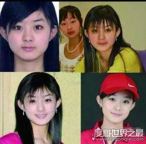 赵丽颖整容前后照片对比,整张脸完全不同了