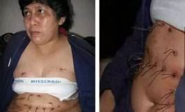 无法解释的民间怪事，身上长铁丝的女人（无奇不有）