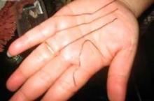 无法解释的民间怪事，身上长铁丝的女人（无奇不有）