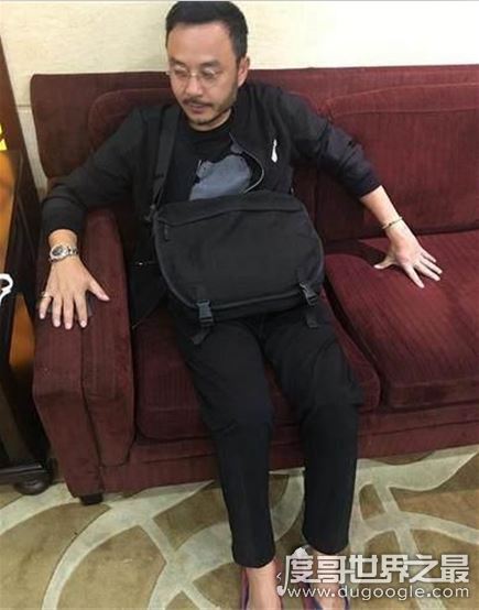 汪涵肝硬化是不是真的,本人亲自澄清(只是一般肝病)