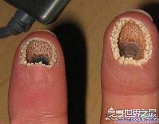 能把人恶心到吐的图片，世界十大最恶心的图片(胆小勿入)