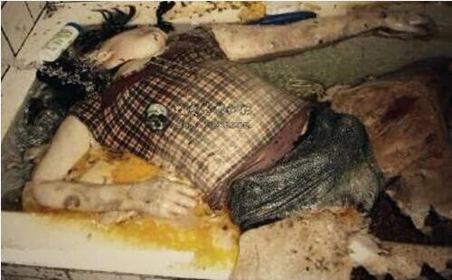 能把人恶心到吐的图片，世界十大最恶心的图片(胆小勿入)