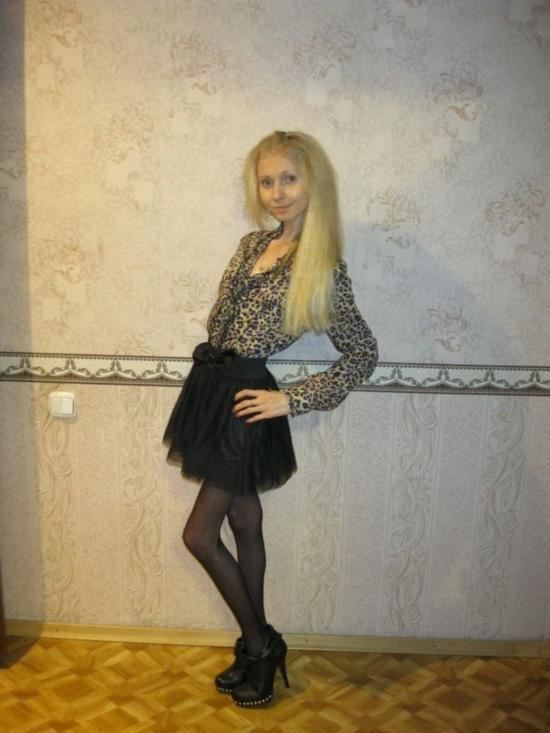 世界上最瘦的人，kseniya bubenko骨瘦如柴仅20公斤(惊悚)