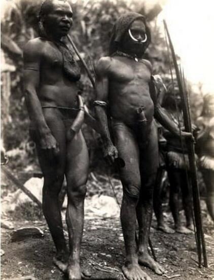 揭秘非洲象人族真相，象人族真实照片欣赏(JJ最长达56cm)