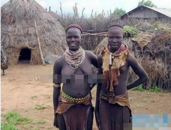 揭秘非洲象人族真相，象人族真实照片欣赏(JJ最长达56cm)