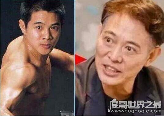 李连杰得了什么病，浑身是伤还得了甲亢(遗嘱准备好了)