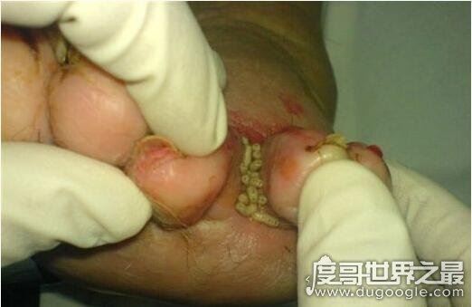 史上最恶心的图片，莲蓬乳/空手指超恶心图片合集(慎入)