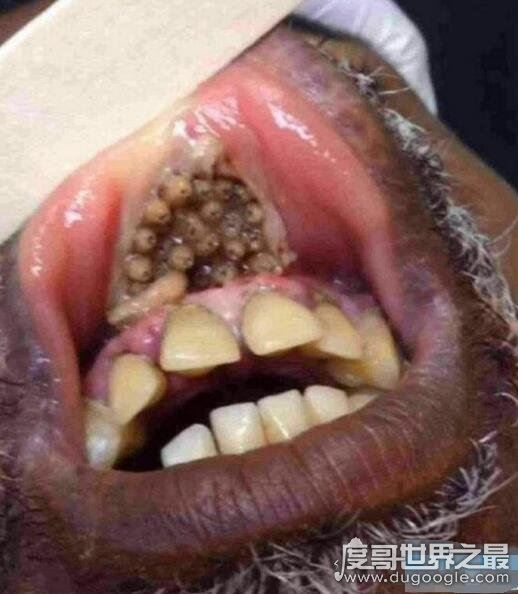 史上最恶心的图片，莲蓬乳/空手指超恶心图片合集(慎入)