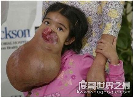 史上最恶心的图片，莲蓬乳/空手指超恶心图片合集(慎入)