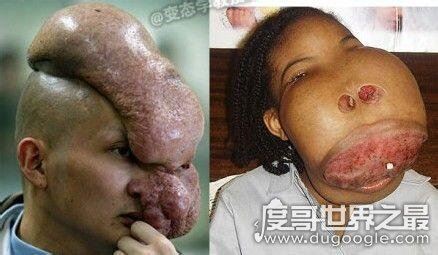 史上最恶心的图片，莲蓬乳/空手指超恶心图片合集(慎入)