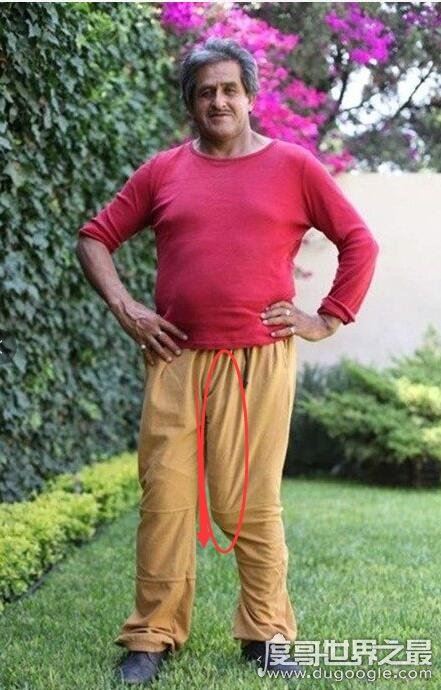 世界上最大的阴茎，所发现的最长纪录为48厘米(疲软状态)