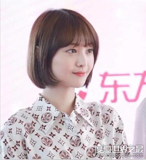 郑爽嘴角伤疤原因，因拍摄电视剧不小心被烫伤(并不是整容失败)