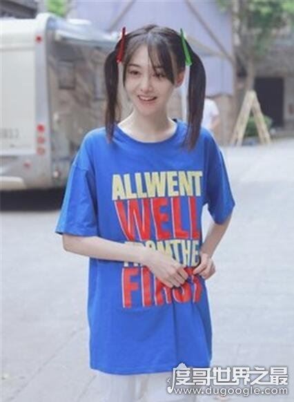 郑爽嘴角伤疤原因,因拍摄电视剧不小心被烫伤(并不是整容失败)