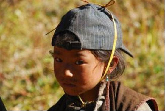 世界上十大兽孩,被各类野兽兽化的孩子(让人痛惜)