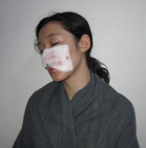 骇人听闻的啃脸案 ，原来不止一个啃脸男（丧心病狂）