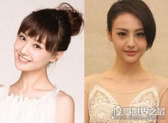 郑爽整容前后照片对比,整容失败后悔如今颜值回升