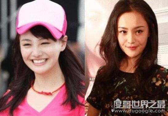 郑爽整容前后照片对比，整容失败后悔如今颜值回升