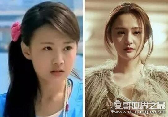 郑爽整容前后照片对比，整容失败后悔如今颜值回升