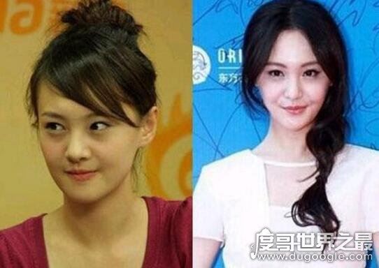 郑爽整容前后照片对比,整容失败后悔如今颜值回升