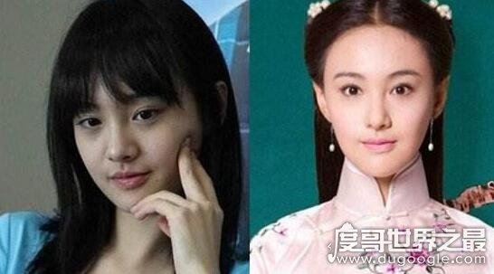 郑爽整容前后照片对比，整容失败后悔如今颜值回升