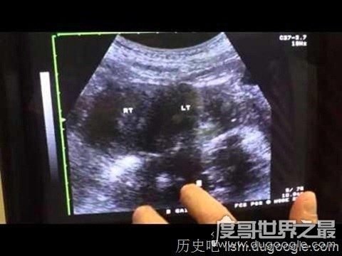 魏吉娜是什么意思,世界最强魏吉娜夹起30斤重物
