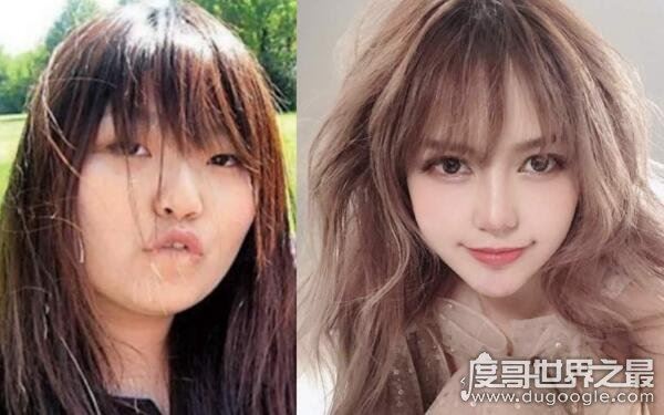 周扬青整容前后对比,眼睛变化巨大(主要和减肥有关)