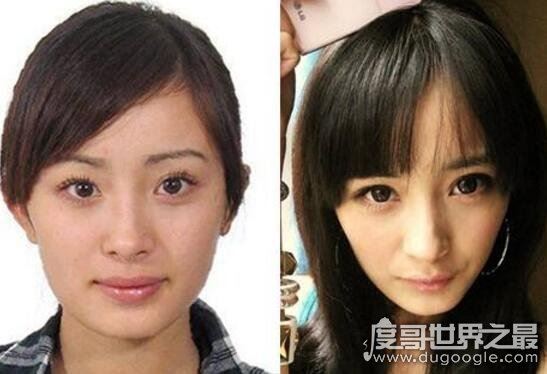 杨幂整容前后照片对比，整容失败留下后遗症曝光