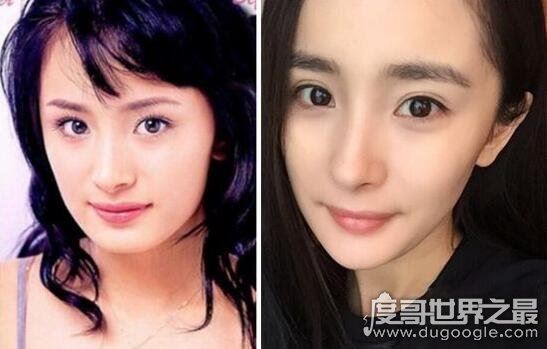 杨幂整容前后照片对比，整容失败留下后遗症曝光