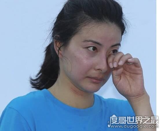 郭晶晶眼睛要失明吗，年轻时训练太拼对眼睛伤害大已近失明