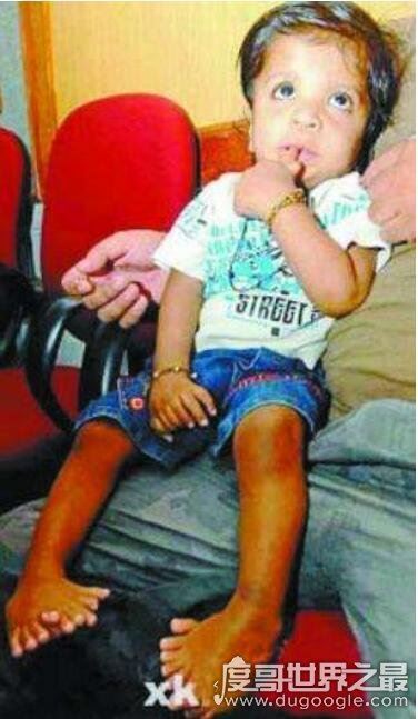 世界上35个人体之最,关于人类的35个吉尼斯世界纪录盘点