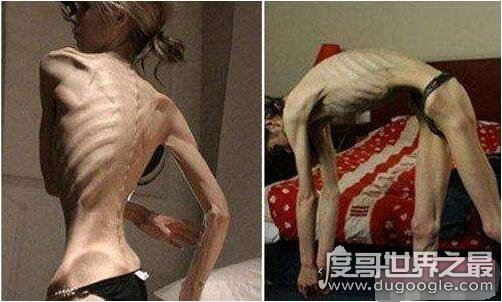 世界上35个人体之最，关于人类的35个吉尼斯世界纪录盘点