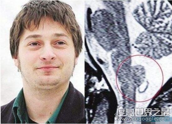 世界上35个人体之最,关于人类的35个吉尼斯世界纪录盘点