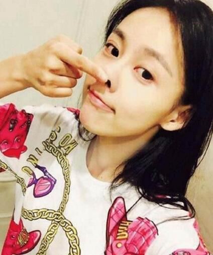 贾青整容前后照片对比，自曝素颜照捏鼻证清白