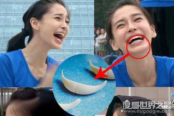 angelababy整容前方脸塌鼻梁厚嘴唇，前后照片大对比