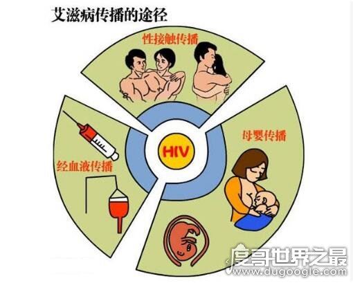 艾滋病起源的罪魁祸首，起源于非洲黑猩猩(之后被人为传播)