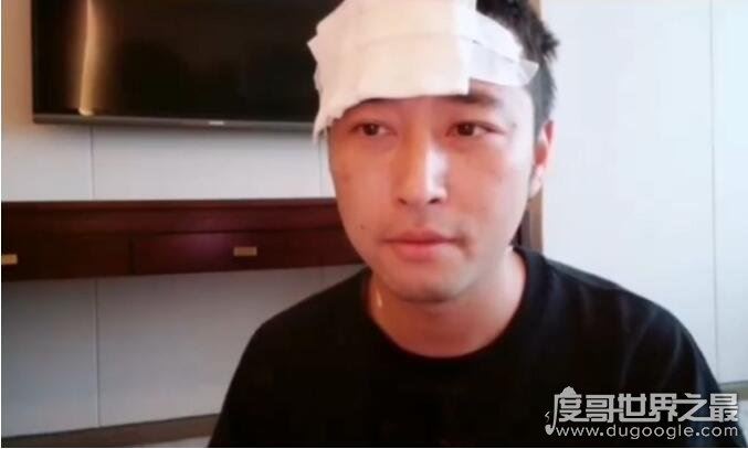 斗鱼高冷男神钱小佳,直播途中被粉丝用酒瓶袭击头部(影响恶劣)