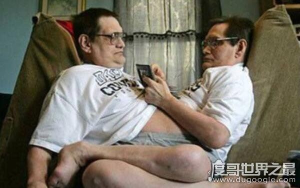 全球十大恐怖怪病，让人心生恐惧（怪病）