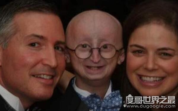 全球十大恐怖怪病，让人心生恐惧（怪病）